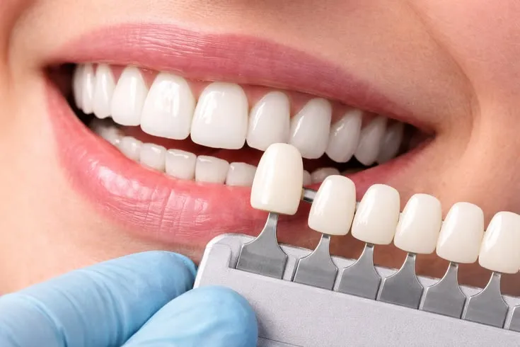 Phục hình Zirconia